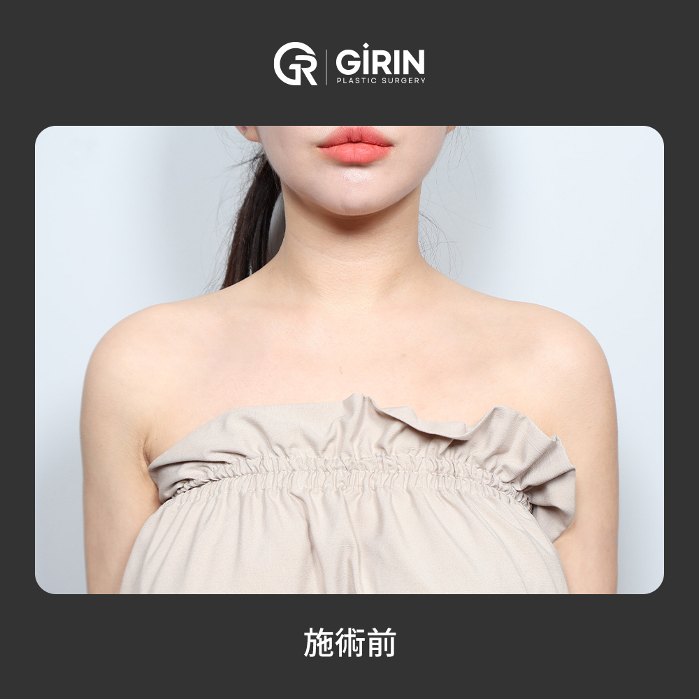 首と肩のラインが滑らかに繋がる効果