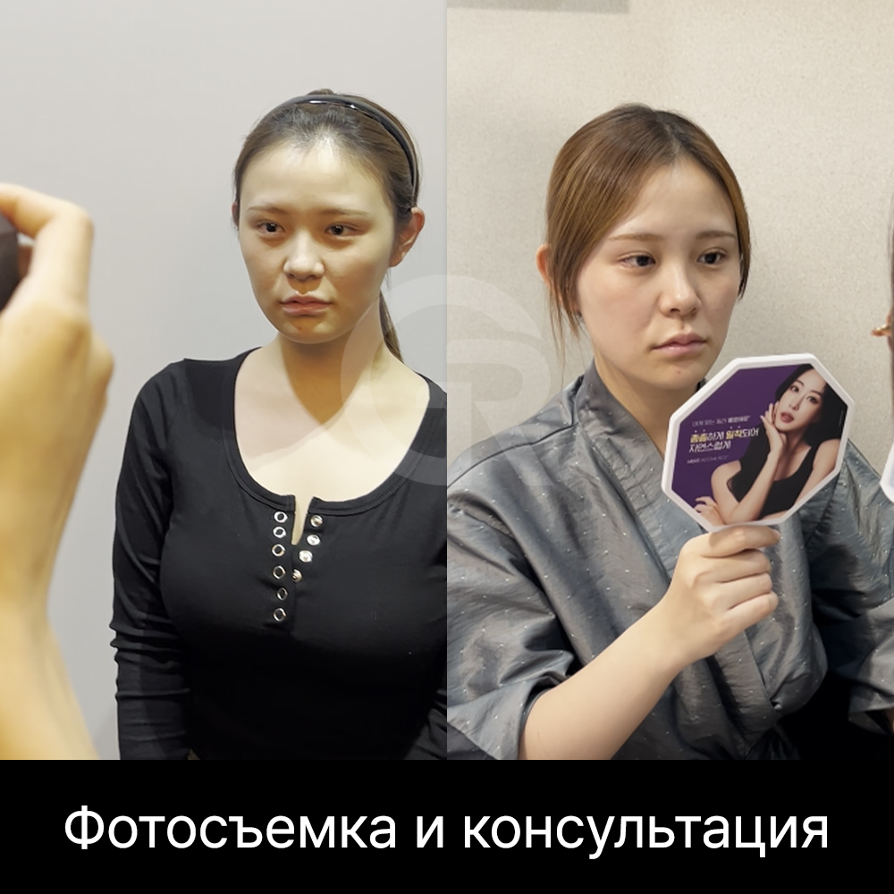 При мясистом или коротком носе важно оценивать не только переносицу, но и направление кончика носа, колумеллу и видимость ноздрей.