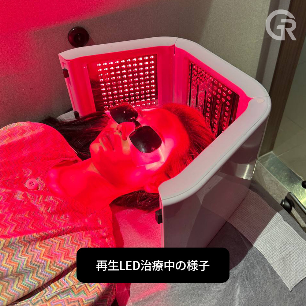 再生レーザーによる頭皮環境ケア