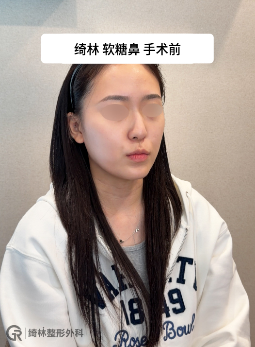 在无菌环境中加工软骨微粒，保持组织活性与弹性。