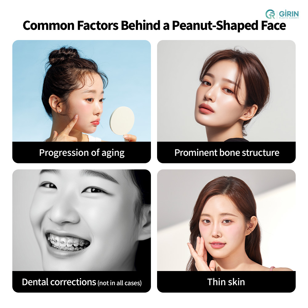 Age-related facial volume loss occurs gradually and affects specific fat compartments of the face.