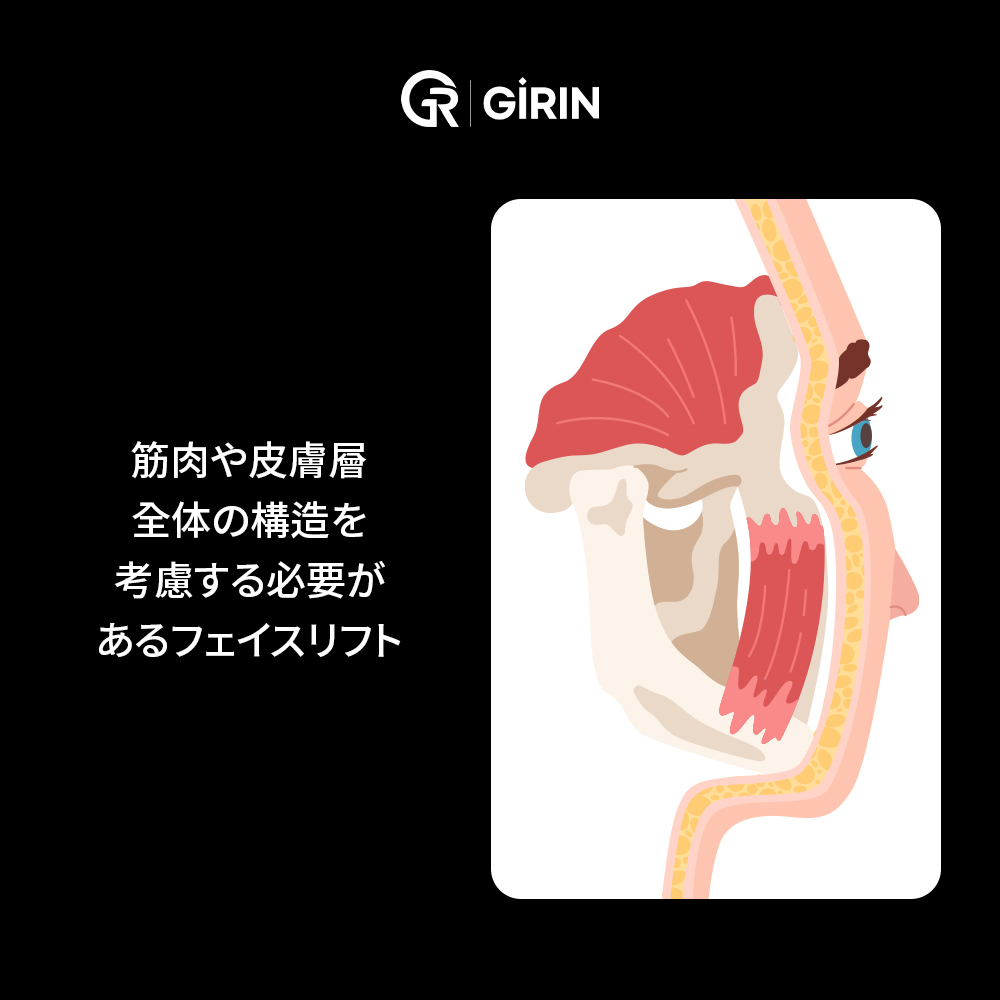 フェイスリフト後の一般的な回復経過