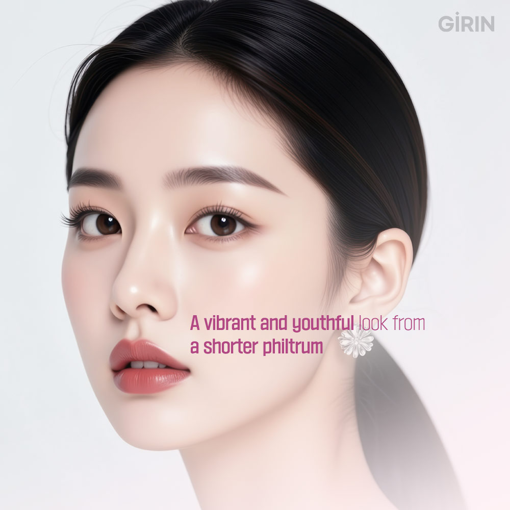 Comparison of philtrum reduction methods: filler, Botox, threads