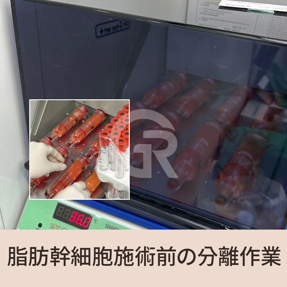 髪の成長サイクルが乱れることで成長期が短くなり、結果として髪は徐々に細く弱くなっていきます