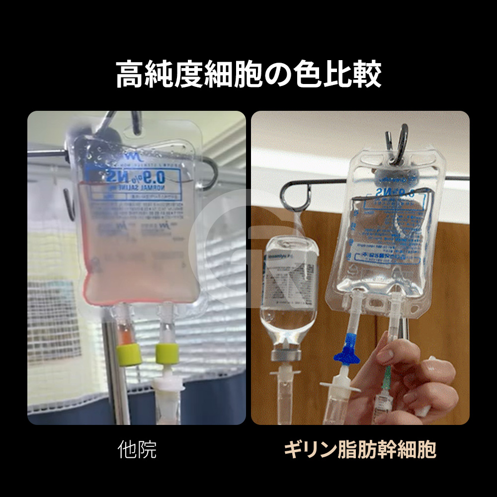 手作業による酵素分離技術により、従来の遠心分離よりも高純度の幹細胞抽出が可能になります。
