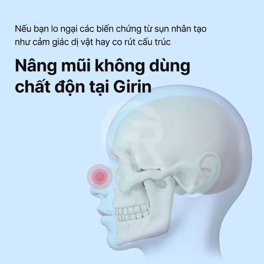 Nâng mũi kín giúp chỉnh sửa mũi đầu tròn thông qua đường rạch bên trong lỗ mũi.