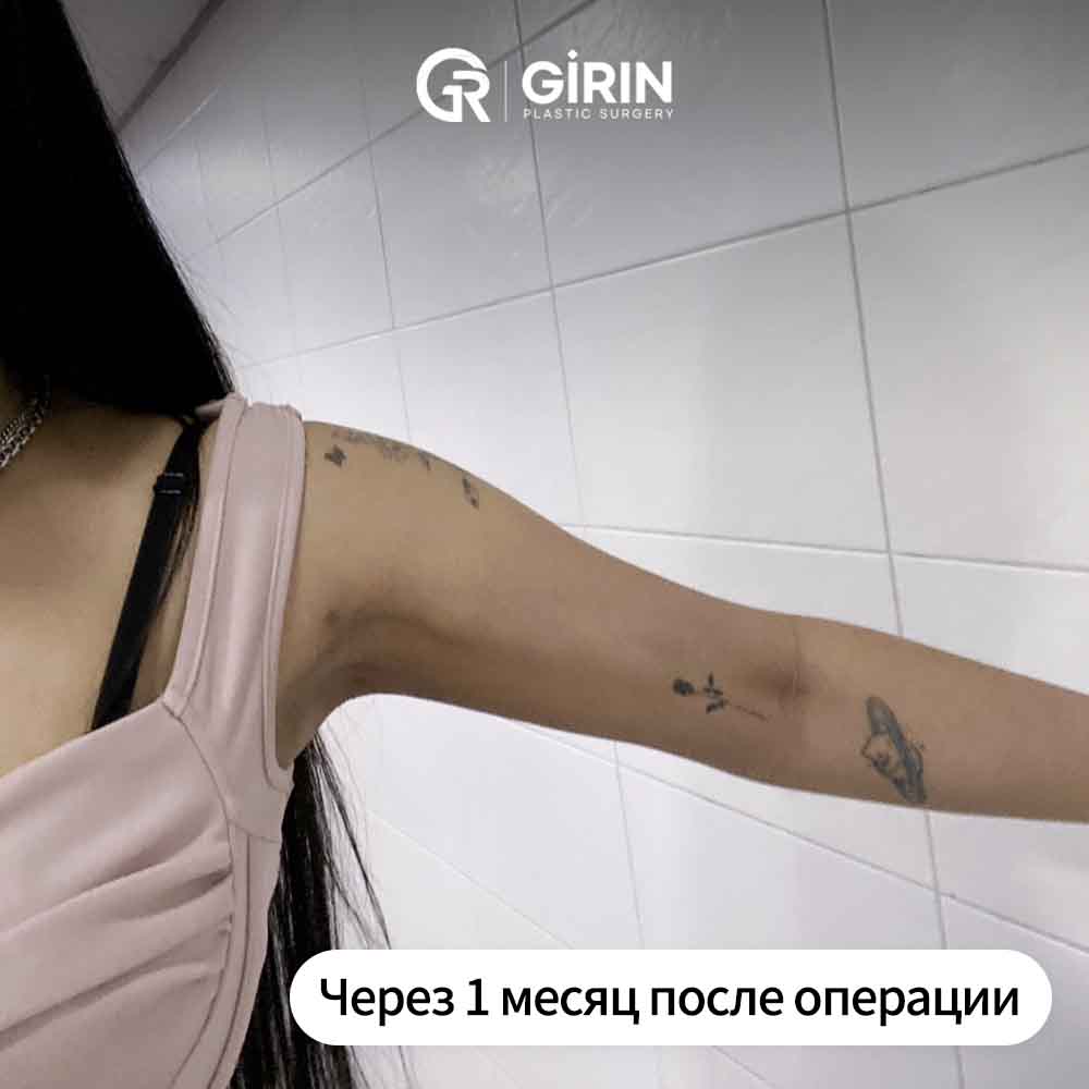 Доктор клиники Girin выполняет операцию под контролем