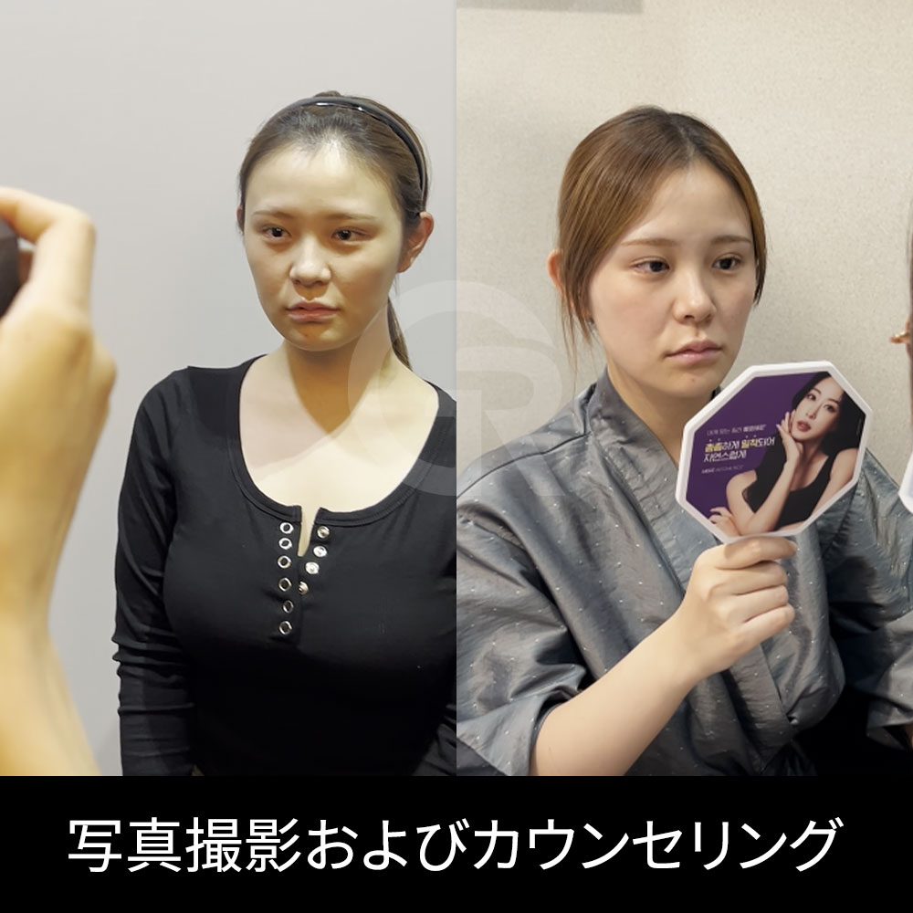 団子鼻や短い鼻では、鼻先の方向、鼻柱の長さ、小鼻の位置を一緒に確認することが重要です。