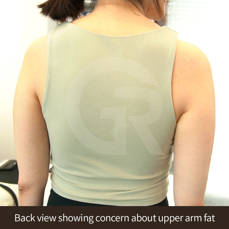 Fat-dominant upper arms often increase in size with weight gain.