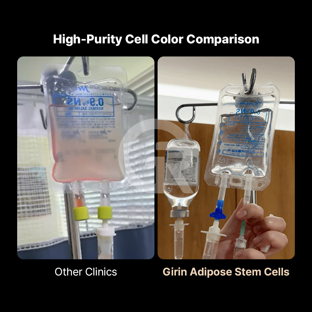Manual enzyme-based isolation improves stem cell purity compared to conventional centrifugation.