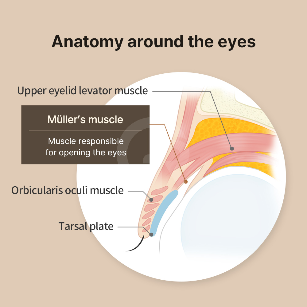 Drooping eyelids are not caused by a single factor but by changes in skin, muscle, and brow position.