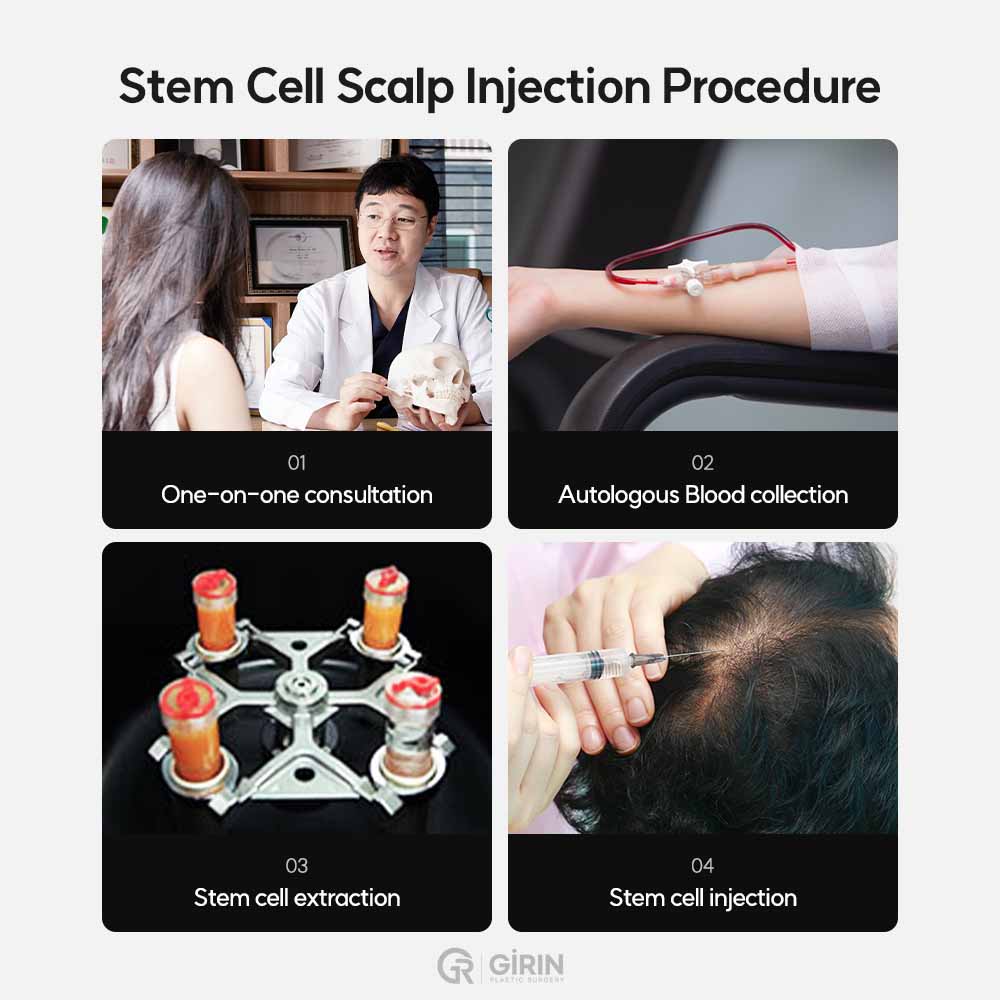 Differences between stem cell therapy and PRP.