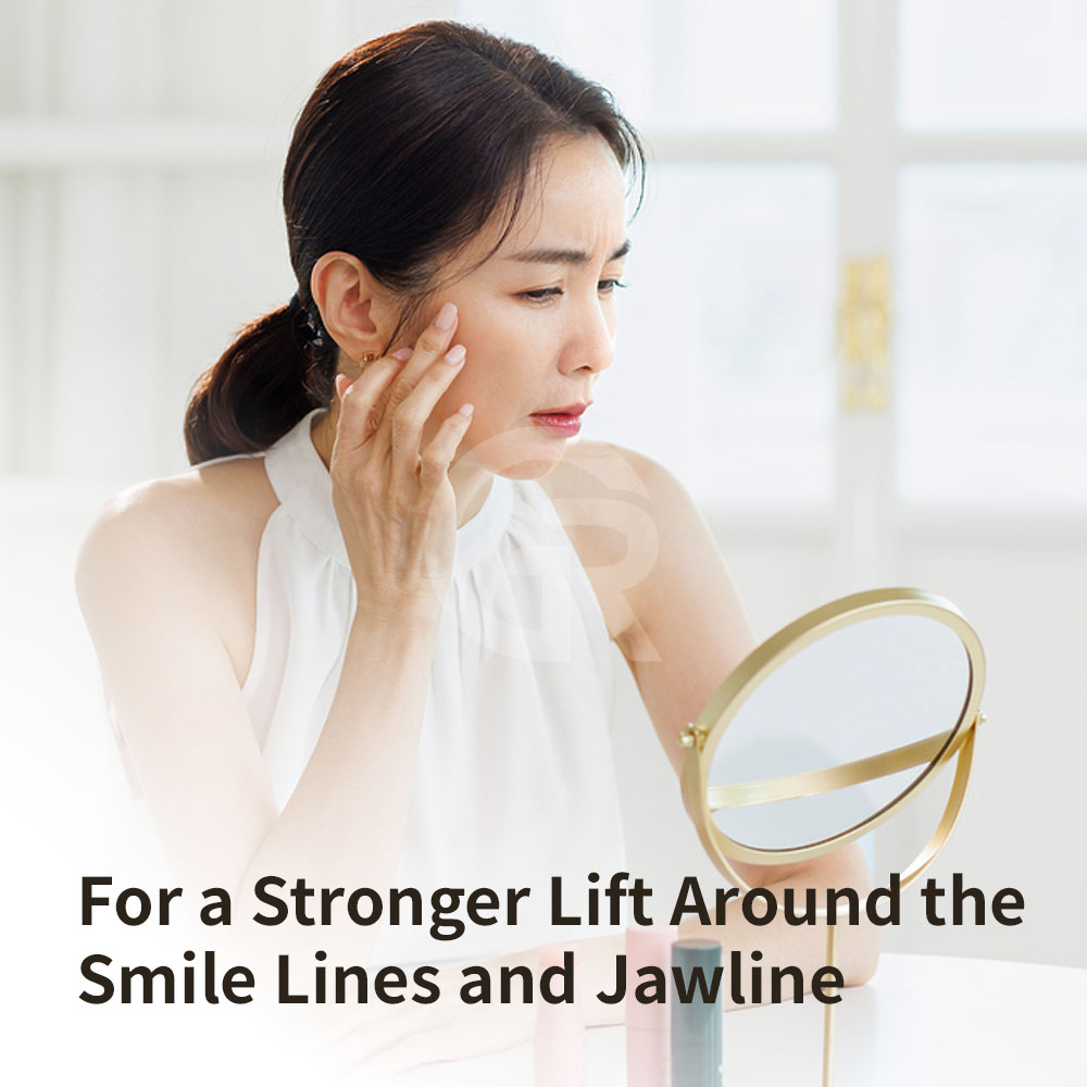 A mini facelift review from Girin Plastic Surgery in Gangnam, Korea, showing improvement in deep nasolabial folds and marionette lines.