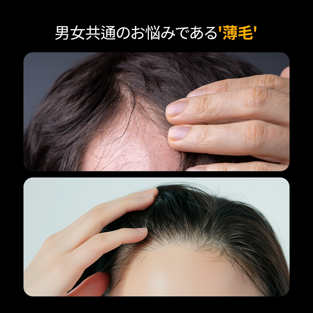 乾燥・脂性・敏感など、韓国クリニックで多く見られる頭皮タイプの比較。