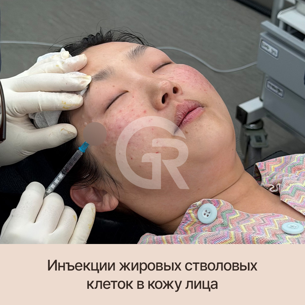 Потеря объема волос? Причина может быть глубже — в ослаблении фолликулов