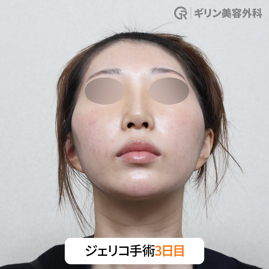 長期間維持できる傷跡ゼロのナチュラルな仕上がり