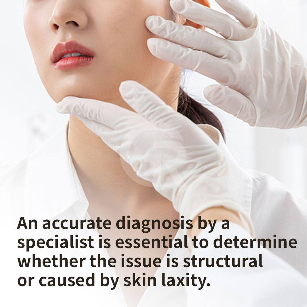 Mini facelift at Girin Plastic Surgery in Gangnam, Korea, planned to naturally improve sagging around the mouth and deep nasolabial folds.