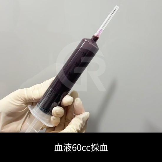 薄い肌の治療計画は、長期的な構造安定を重視して立てられます。