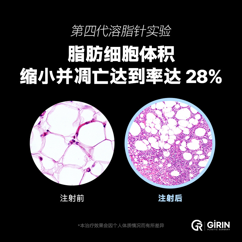 轮廓溶脂针有效分解下巴脂肪，打造立体面部曲线