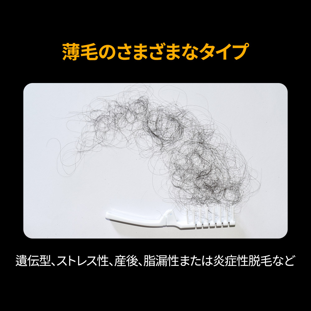 江南・瑞草エリアで行う医師による詳細な頭皮診断。