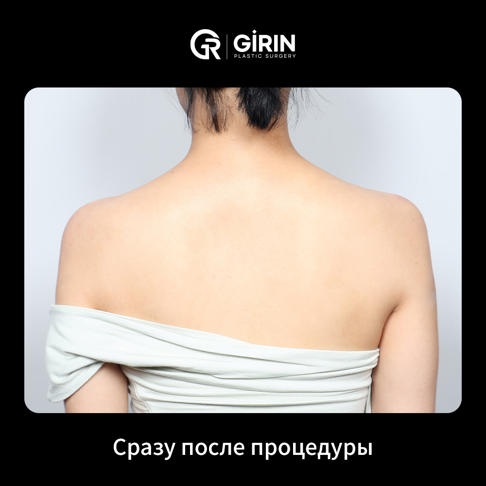 9ef9c6d992a78.jpg