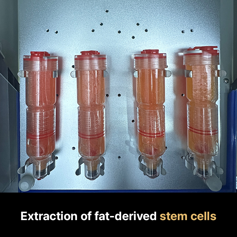 Why some stem cell injections in Korea use fat tissue instead of blood as a cell source.