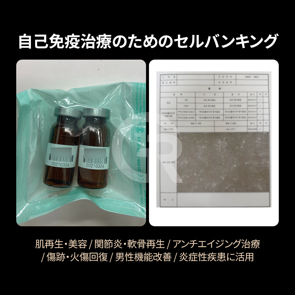 マイナス196度の液体窒素環境で保存することで、幹細胞の生存性を長期間維持します。
