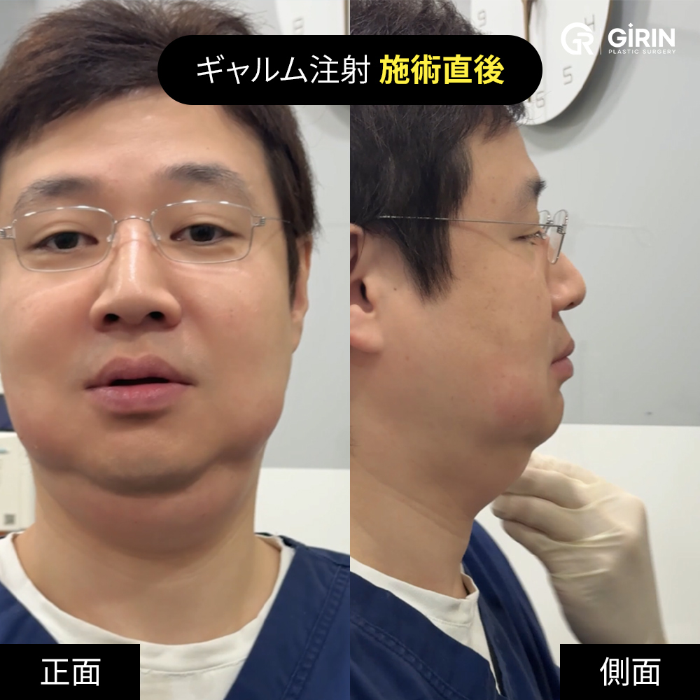 施術部位：腕・お腹・太もも