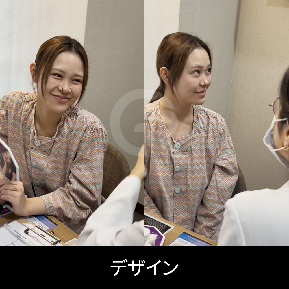 ギリン美容外科では、もともとの鼻の構造と顔の比率に合わせて鼻整形のデザインを計画します。