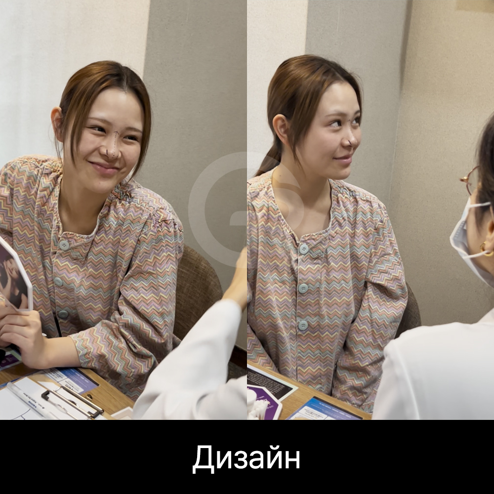 Мягкая прямая линия с легким изгибом кончика носа помогает создать более женственный и утонченный профиль.