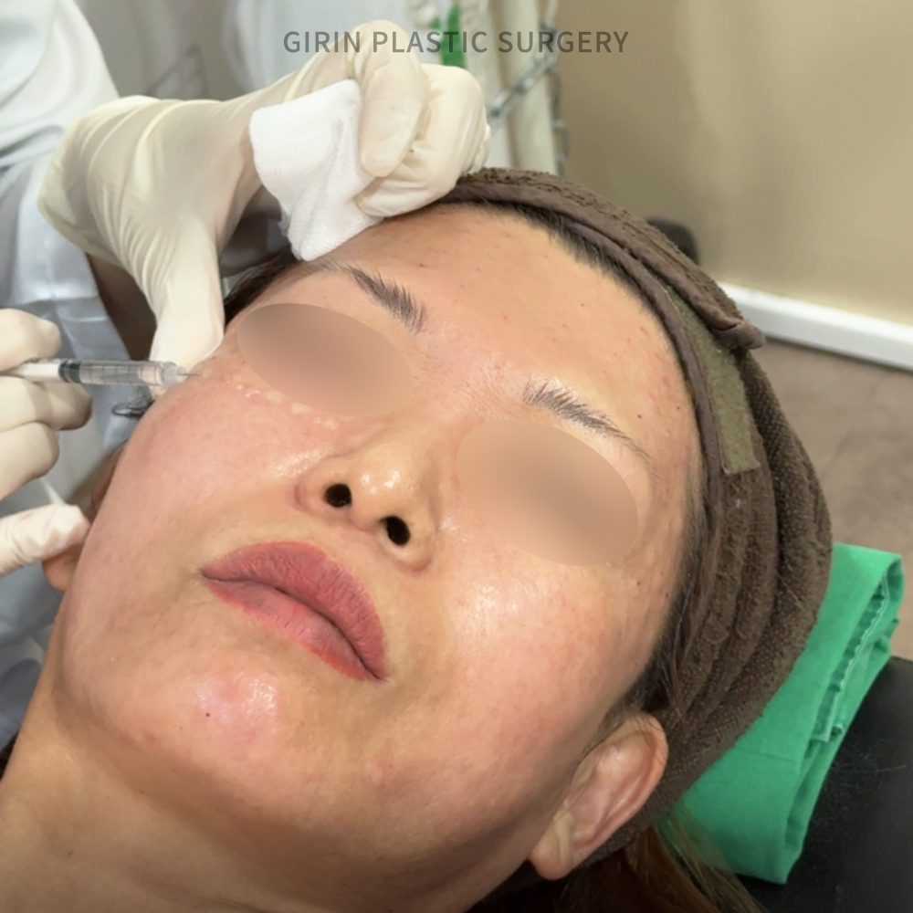 DERMATOLOGY IN GANGNAM