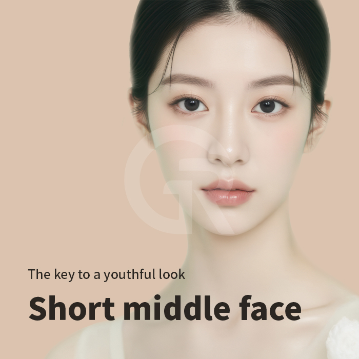 Vertical midface lift focuses on structural repositioning rather than simply tightening the skin surface.