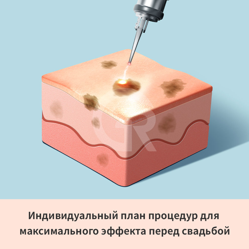 Skinvive помогает улучшать внутреннюю среду увлажнения кожи и создавать естественное сияние кожи.