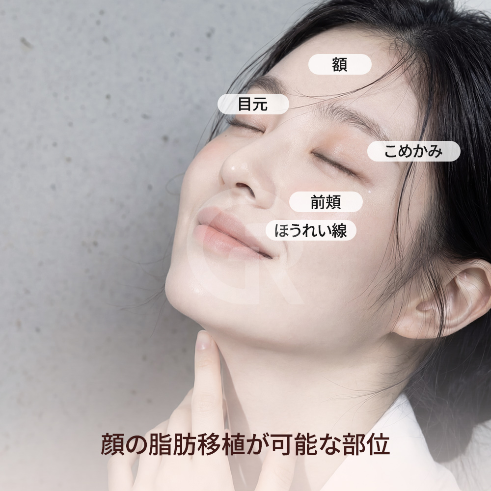微細脂肪注入の目的は、自然なボリュームと調和の取れたフェイスラインを作ることです。