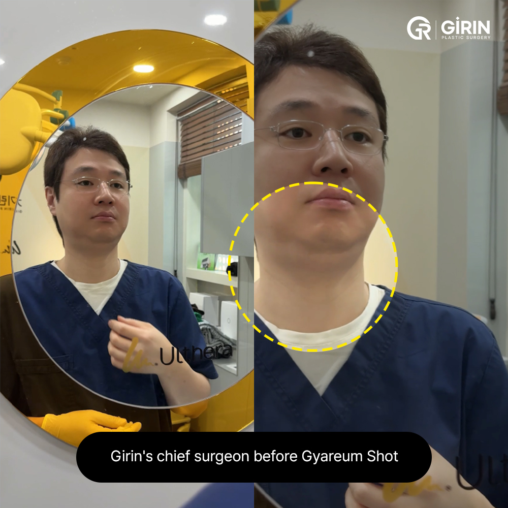 glutathione oral health Beyond Brightening: Jane Rog's Real Skin Transformation in Korea