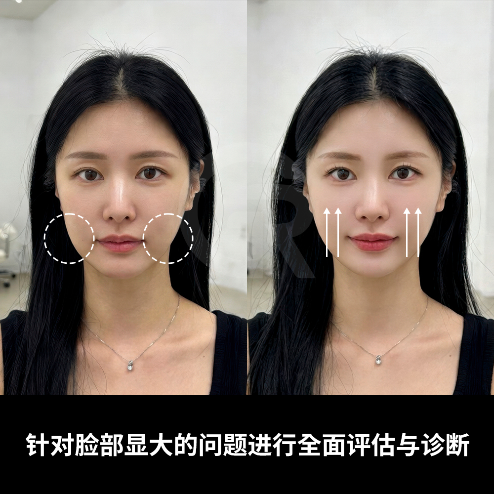 面部轮廓偏圆润柔和女明星图片- 抖音, image size:1000x1000