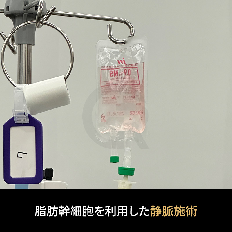 SVFを静脈投与する方法は、全身循環を通じた支持的アプローチとして研究されています。