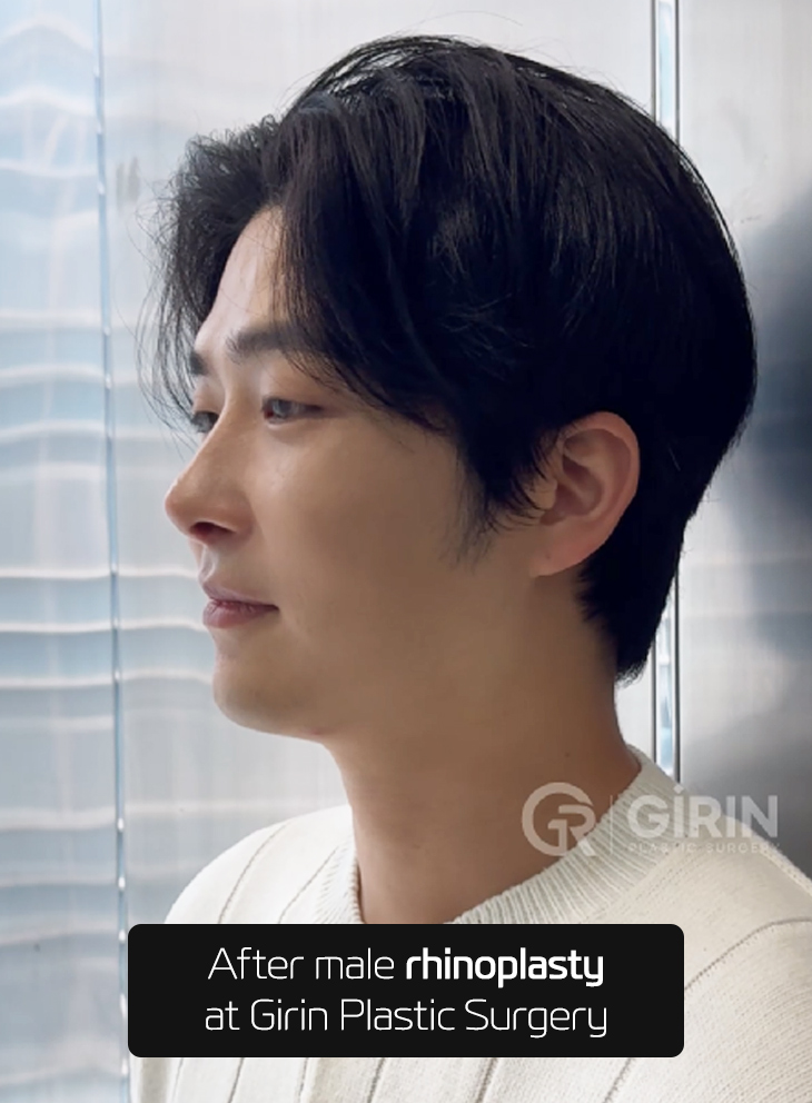 Girin Plastic Surgery — professional Korean rhinoplasty hospital.