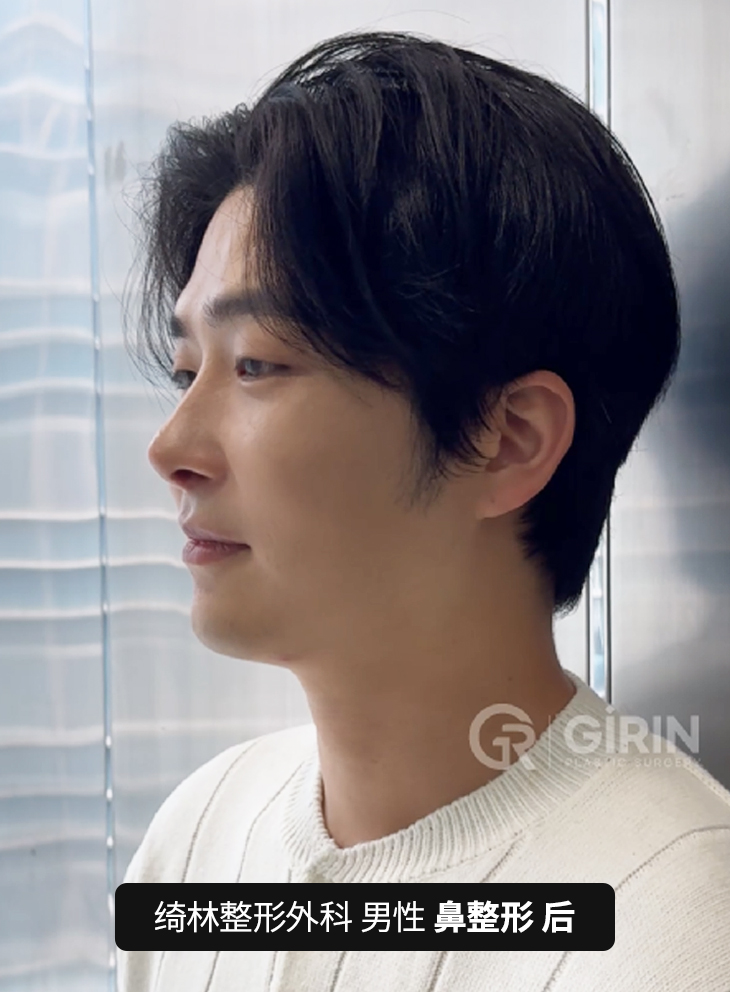 绮林整形外科 — 韩国专业鼻整形医院。