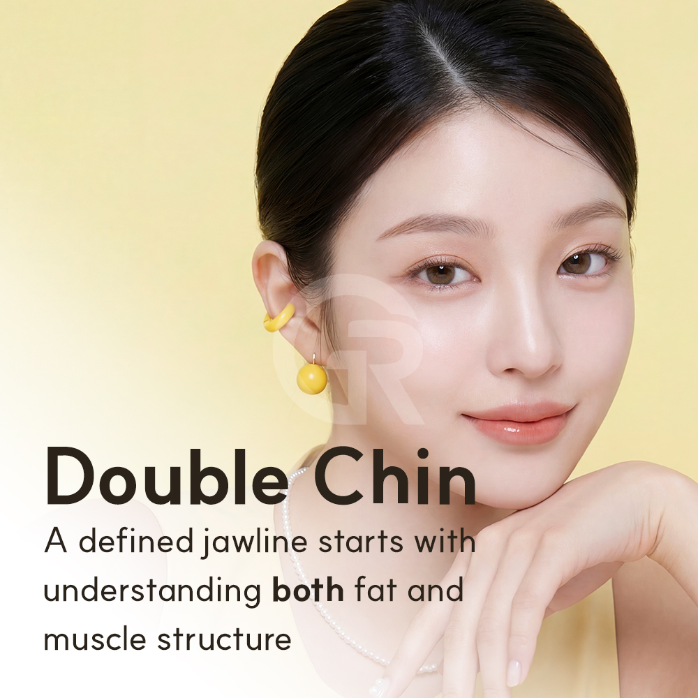After weight loss, the face may look more sagged when volume decreases and soft tissue support changes.