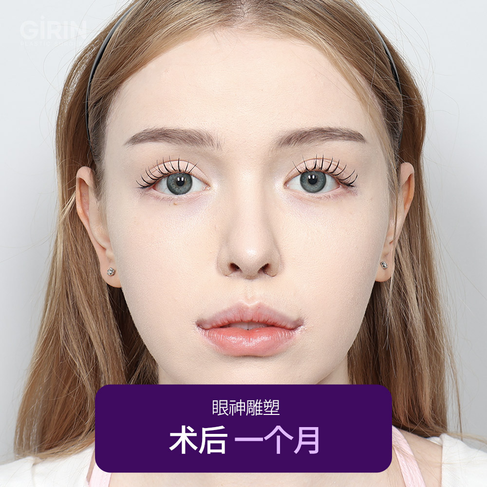 实际患者案例:自然又有神的转变。