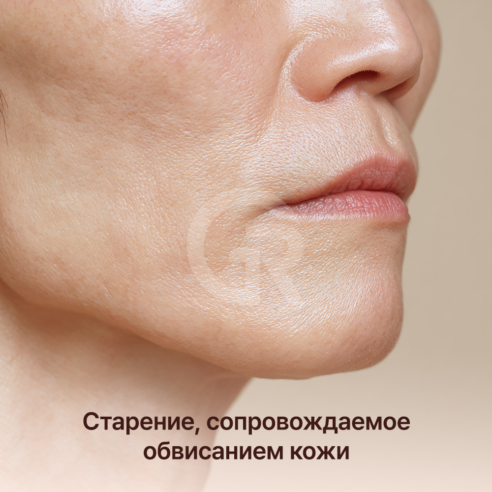 Результат липофилинга зависит не только от объема введенного жира, но и от того, какая его часть стабильно приживется.