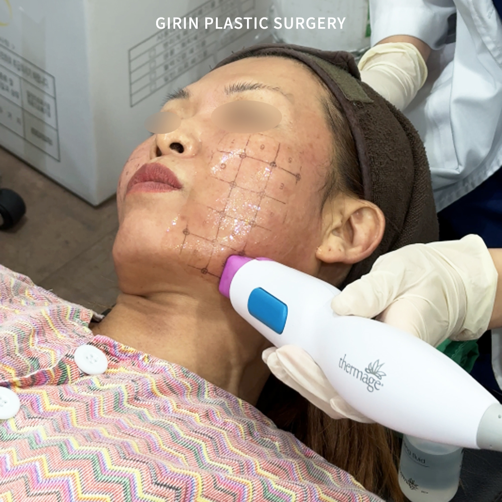Gangnam Thermage FLX treatment