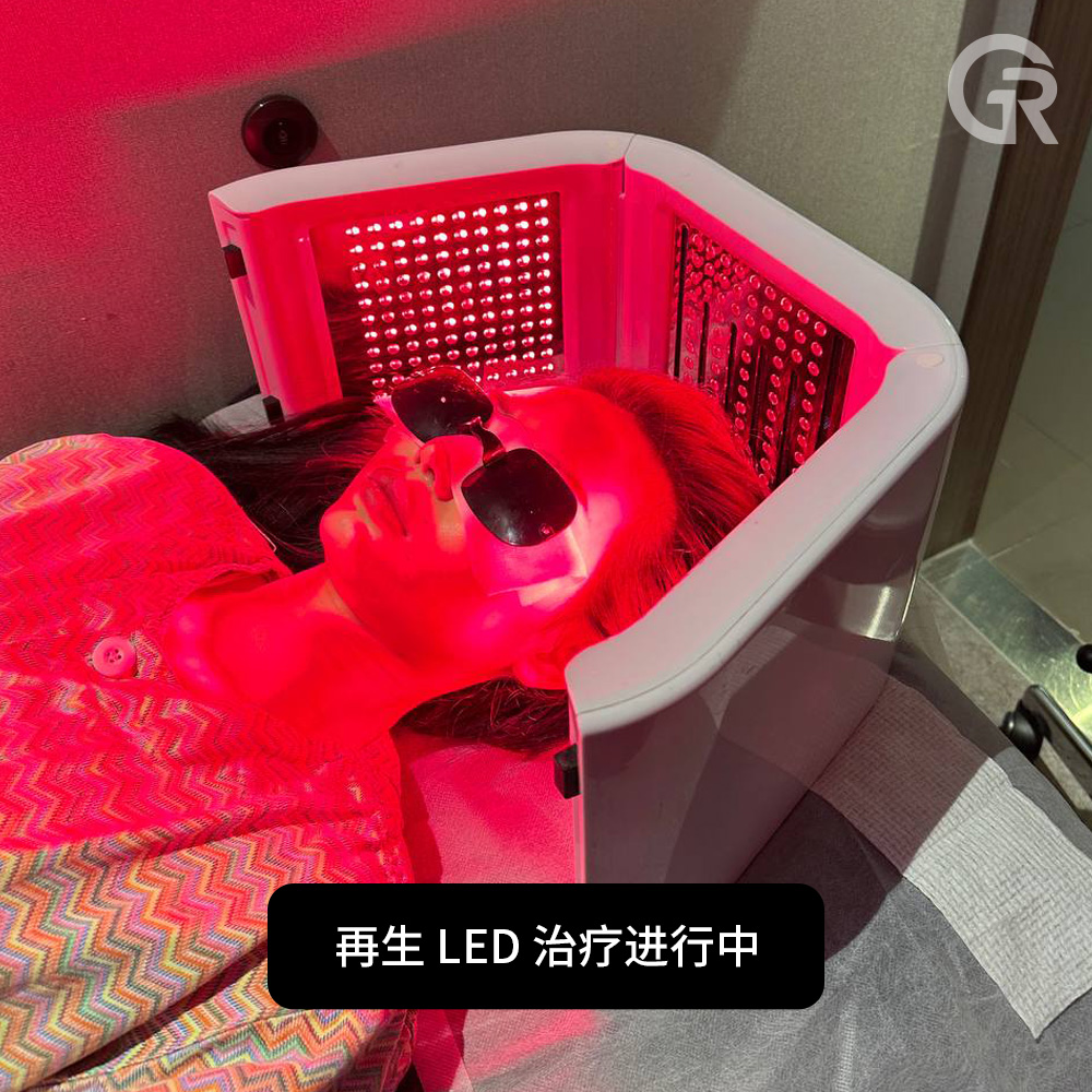 再生激光辅助头皮修复