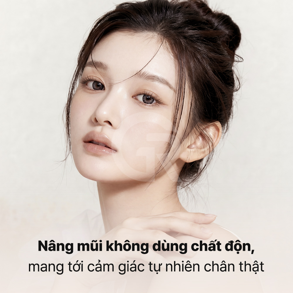 Nâng mũi không dùng sụn nhân tạo có thể giúp cải thiện đầu mũi tròn mà vẫn giữ được nét tự nhiên.