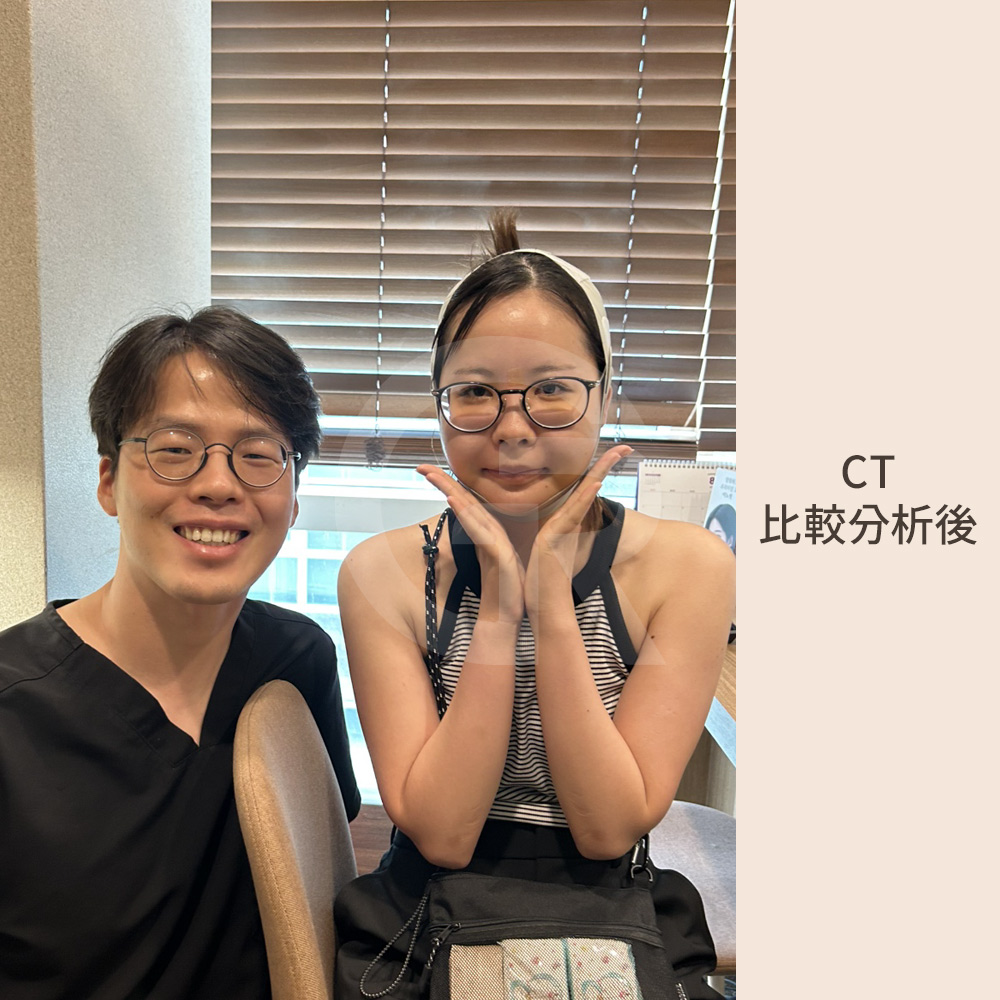 ギリン整形外科での両顎手術後の顔の変化