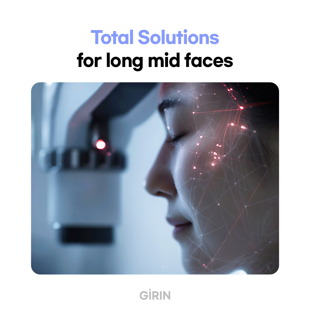 Cheek lifting with thread lift in Korea for sagging midface