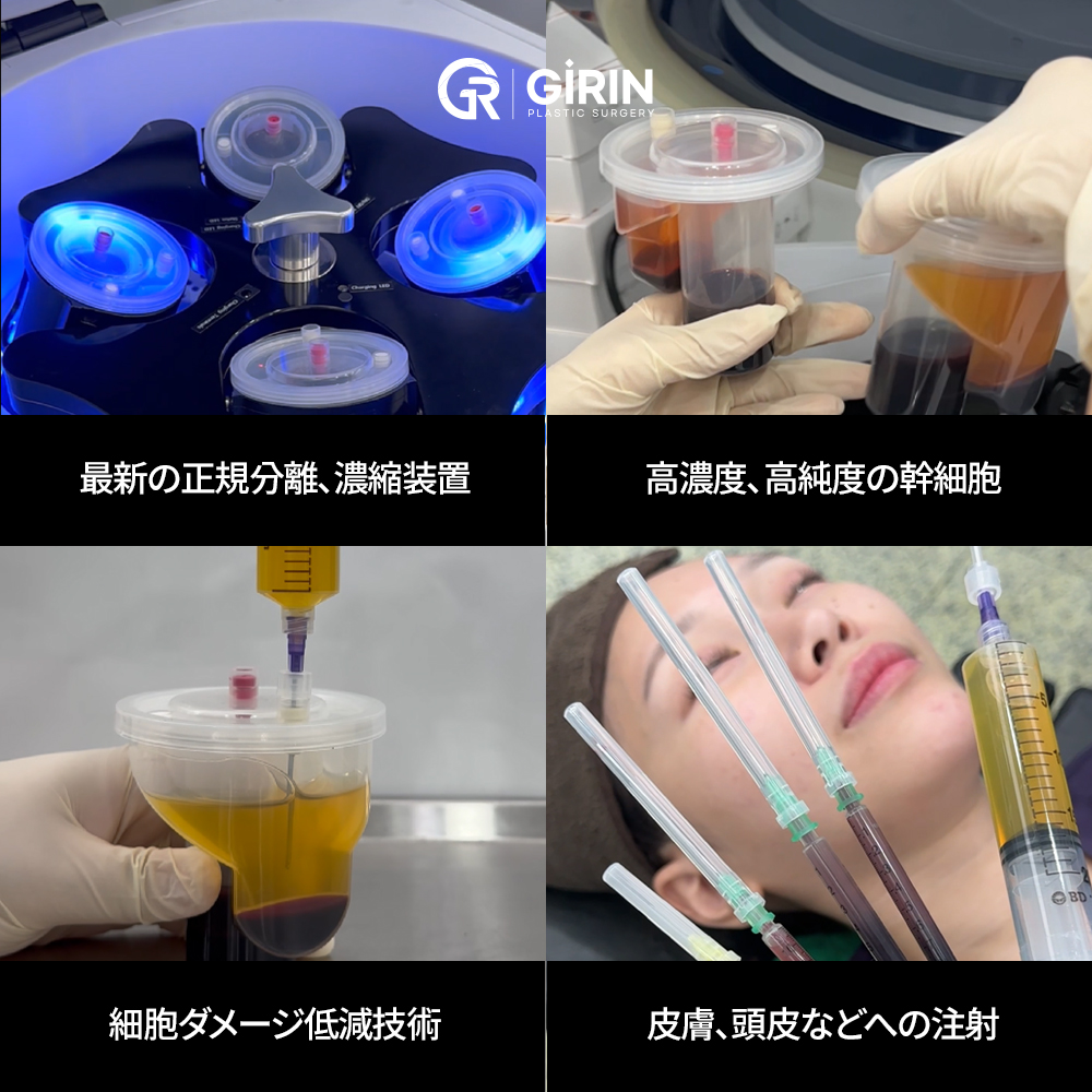 施術前の医師による個別カウンセリング
