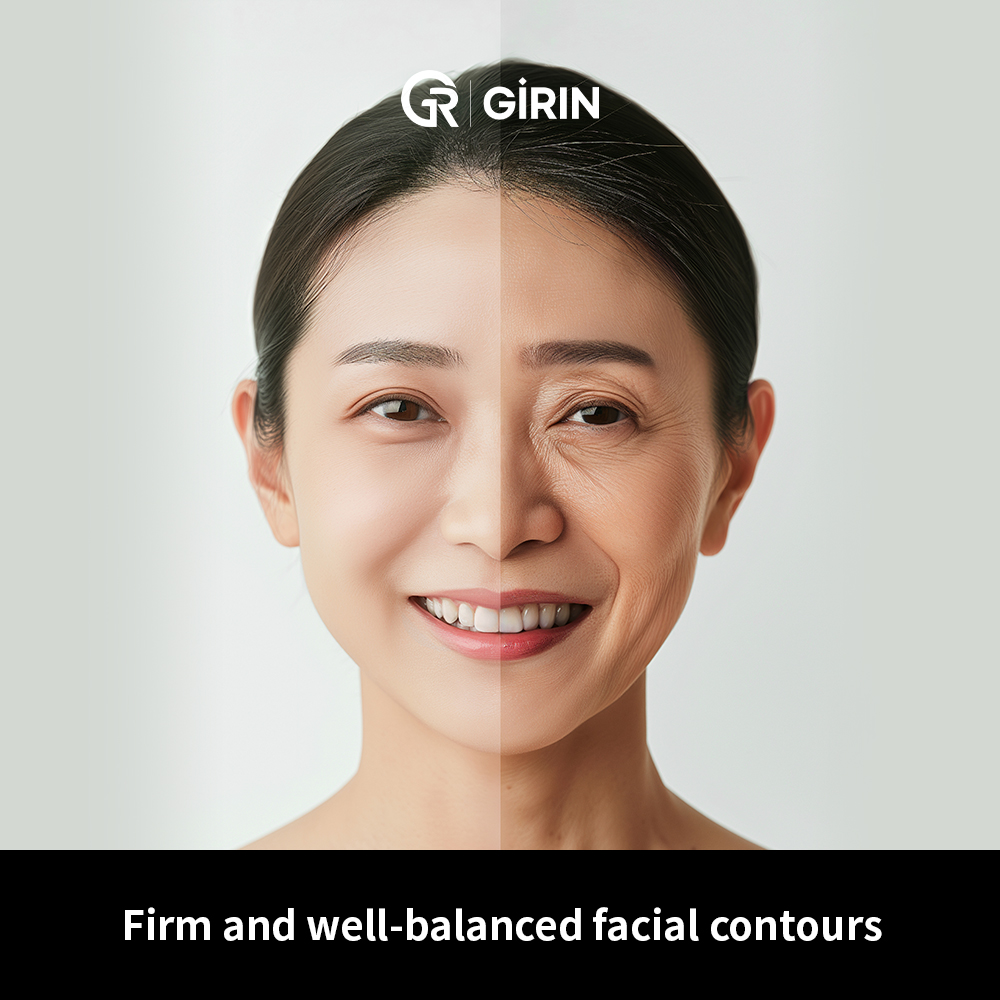 Incision design plays an important role in facelift outcomes