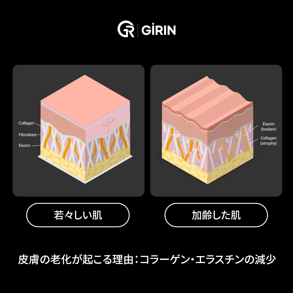 中顔面のたるみ評価とフェイスリフト
